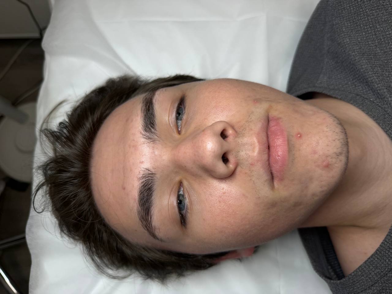 Skin at H.A. Skin Lab, treatment photo