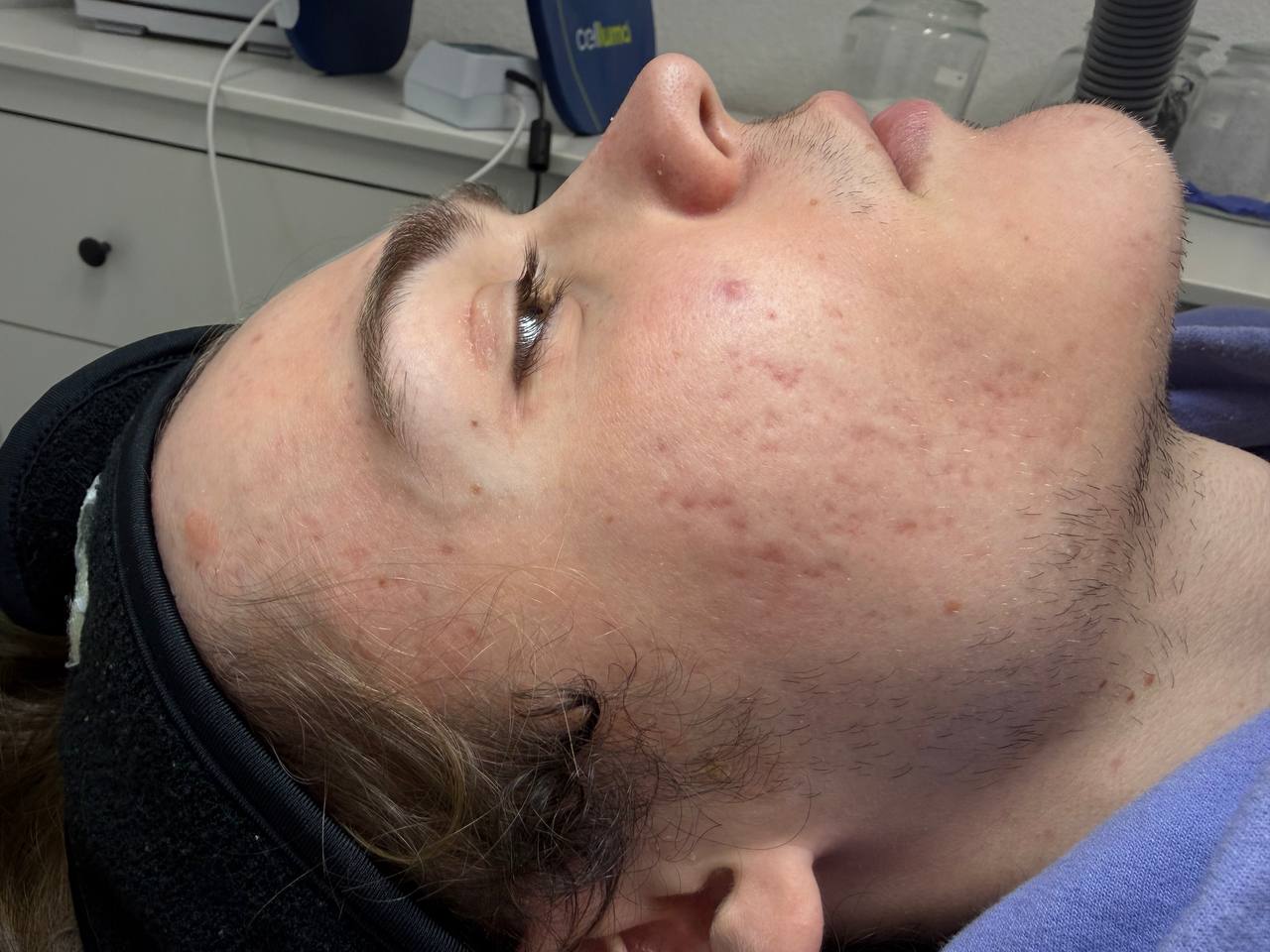 Skin at H.A. Skin Lab, treatment photo