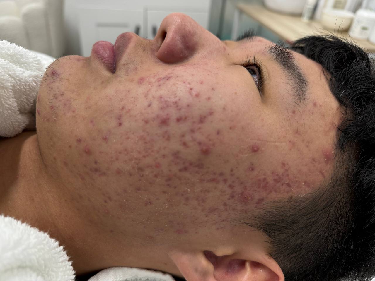 Skin at H.A. Skin Lab, treatment photo