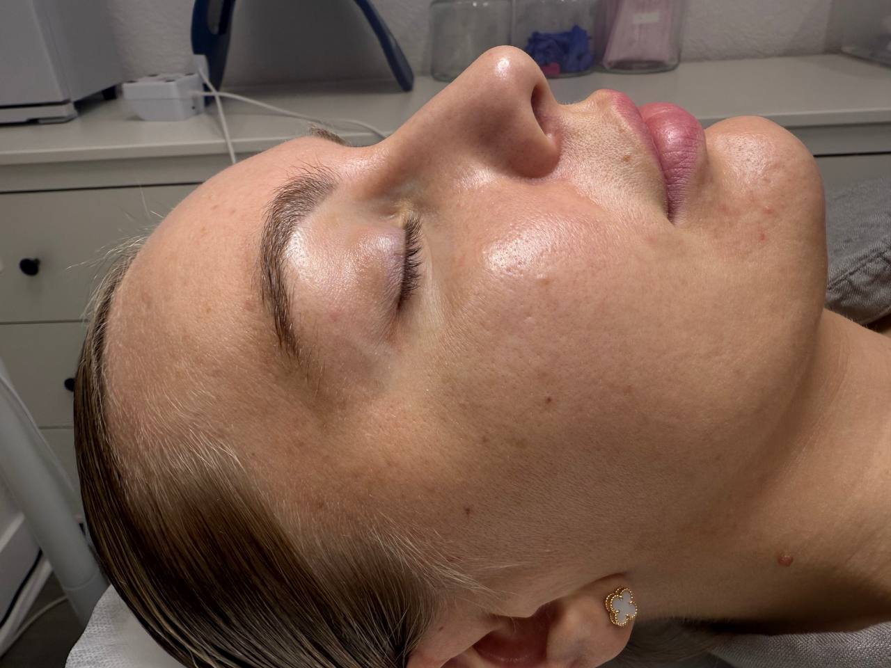 Skin at H.A. Skin Lab, treatment photo