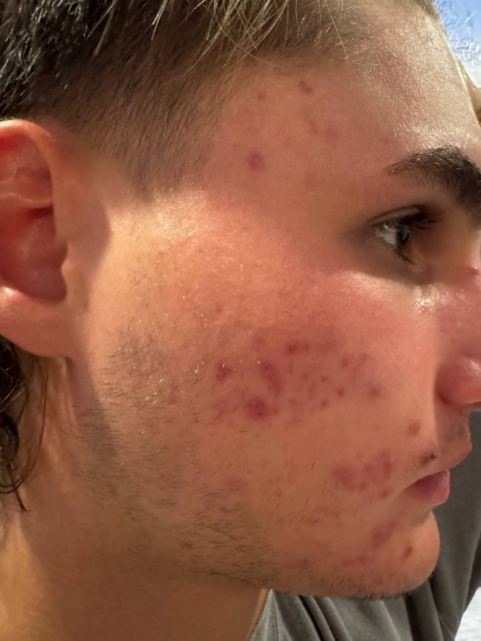 Skin at H.A. Skin Lab, treatment photo