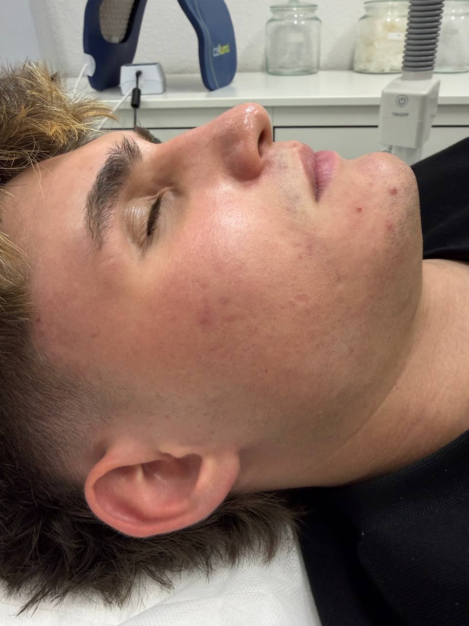 Skin at H.A. Skin Lab, treatment photo