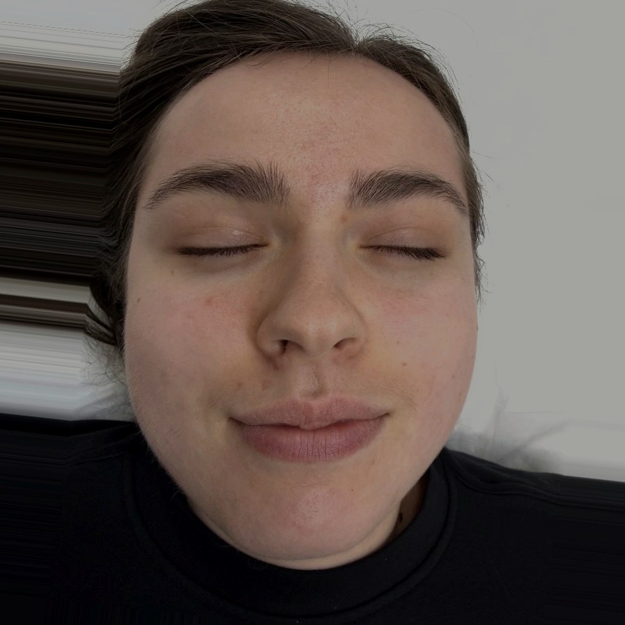 Same client after treatment